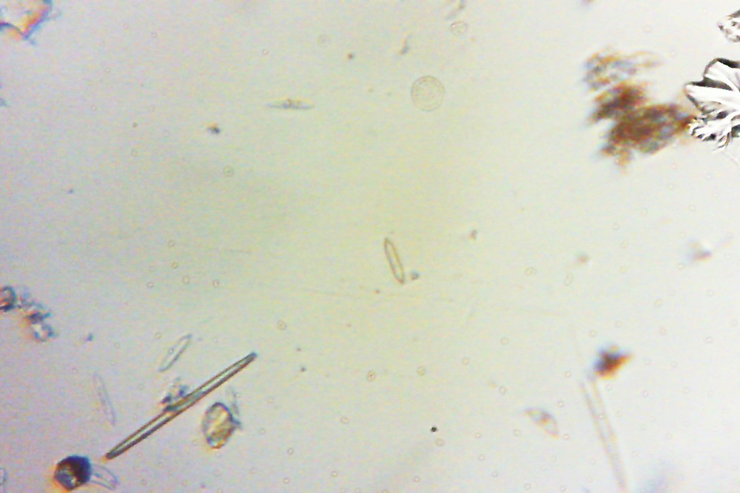 diatoms 3
