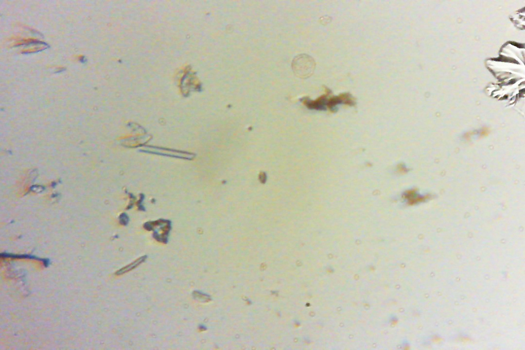 diatoms 4